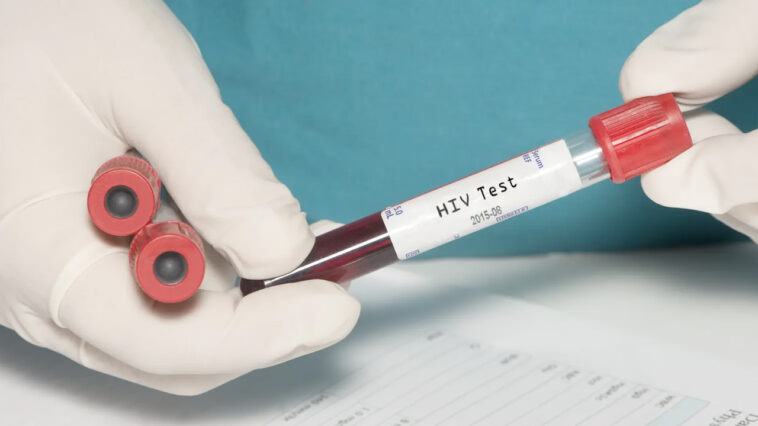 HIV-Test