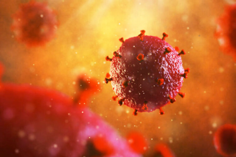 HIV Aids