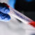 Coronavirus LGBTIQ